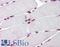 Bromodomain Adjacent To Zinc Finger Domain 1B antibody, LS-B6194, Lifespan Biosciences, Immunohistochemistry frozen image 