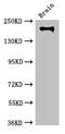 Integrin Subunit Beta 4 antibody, CSB-PA011887LA01HU, Cusabio, Western Blot image 