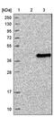 Solute carrier family 25 member 36 antibody, PA5-55492, Invitrogen Antibodies, Western Blot image 