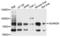 ADAM Metallopeptidase Domain 28 antibody, LS-C411046, Lifespan Biosciences, Western Blot image 