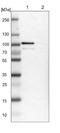 Tetratricopeptide Repeat Domain 14 antibody, NBP1-84657, Novus Biologicals, Western Blot image 