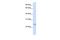 Family With Sequence Similarity 156 Member B antibody, GTX47324, GeneTex, Western Blot image 