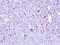 Zinc Finger CCCH-Type Containing 8 antibody, PA5-21811, Invitrogen Antibodies, Immunohistochemistry paraffin image 