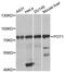 Protection Of Telomeres 1 antibody, MBS126278, MyBioSource, Western Blot image 