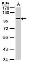 Glycogen phosphorylase, brain form antibody, PA5-28022, Invitrogen Antibodies, Western Blot image 