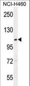 Acyl-CoA Dehydrogenase Family Member 10 antibody, LS-C155926, Lifespan Biosciences, Western Blot image 