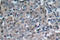 Protein Tyrosine Kinase 2 antibody, LS-C177634, Lifespan Biosciences, Immunohistochemistry frozen image 