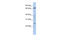 Zinc Finger Protein 510 antibody, 25-479, ProSci, Western Blot image 