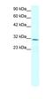 Claudin 17 antibody, orb324486, Biorbyt, Western Blot image 