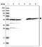 Aldehyde Dehydrogenase 1 Family Member B1 antibody, PA5-54314, Invitrogen Antibodies, Western Blot image 