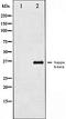 NFKB Inhibitor Beta antibody, orb99455, Biorbyt, Western Blot image 