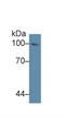 Nucleoporin 98 antibody, LS-C295704, Lifespan Biosciences, Western Blot image 