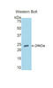 Peroxisome Proliferator Activated Receptor Gamma antibody, LS-C301275, Lifespan Biosciences, Western Blot image 