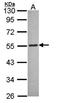 Melanin Concentrating Hormone Receptor 1 antibody, orb73894, Biorbyt, Western Blot image 