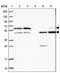 Rho GDP Dissociation Inhibitor Alpha antibody, NBP2-14041, Novus Biologicals, Western Blot image 