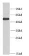 Histone Deacetylase 3 antibody, FNab03798, FineTest, Western Blot image 