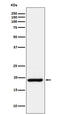 Cold Inducible RNA Binding Protein antibody, M04103, Boster Biological Technology, Western Blot image 