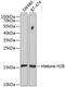 H2B6 antibody, 18-414, ProSci, Western Blot image 