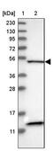 SET Domain Containing 4 antibody, PA5-54971, Invitrogen Antibodies, Western Blot image 