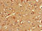 Regulator Of Calcineurin 2 antibody, CSB-PA618879LA01HU, Cusabio, Immunohistochemistry frozen image 