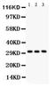 Voltage Dependent Anion Channel 1 antibody, PB9455, Boster Biological Technology, Western Blot image 