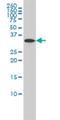 Rab Geranylgeranyltransferase Subunit Beta antibody, H00005876-M02, Novus Biologicals, Western Blot image 