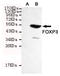 FOXP3 antibody, STJ99099, St John