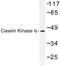 Casein Kinase 1 Epsilon antibody, LS-C176910, Lifespan Biosciences, Western Blot image 