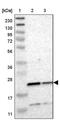 Transmembrane P24 Trafficking Protein 2 antibody, PA5-53120, Invitrogen Antibodies, Western Blot image 