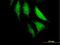 HECT Domain E3 Ubiquitin Protein Ligase 2 antibody, H00143279-B01P, Novus Biologicals, Immunocytochemistry image 