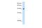 Nuclear Receptor Subfamily 3 Group C Member 2 antibody, GTX46537, GeneTex, Western Blot image 