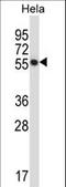 C-Terminal Src Kinase antibody, LS-C167088, Lifespan Biosciences, Western Blot image 