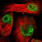 Zinc Finger Matrin-Type 5 antibody, HPA004858, Atlas Antibodies, Immunocytochemistry image 