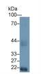 Hexosaminidase Subunit Alpha antibody, LS-C294497, Lifespan Biosciences, Western Blot image 