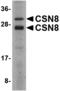 COP9 Signalosome Subunit 8 antibody, A07142, Boster Biological Technology, Western Blot image 
