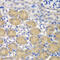 Staphylococcal Nuclease And Tudor Domain Containing 1 antibody, 14-976, ProSci, Immunohistochemistry paraffin image 