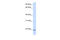 CCHC-Type Zinc Finger Nucleic Acid Binding Protein antibody, 25-230, ProSci, Western Blot image 