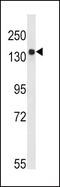 TSC Complex Subunit 2 antibody, PA5-13364, Invitrogen Antibodies, Western Blot image 