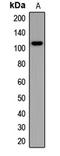 Synaptopodin antibody, LS-C668439, Lifespan Biosciences, Western Blot image 