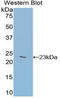 Glucosidase Alpha, Acid antibody, LS-C294221, Lifespan Biosciences, Western Blot image 