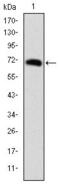 Forkhead Box P2 antibody, GTX60499, GeneTex, Western Blot image 