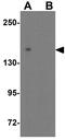 Unc-51 Like Kinase 4 antibody, GTX31562, GeneTex, Western Blot image 