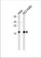 NME/NM23 Nucleoside Diphosphate Kinase 1 antibody, TA324580, Origene, Western Blot image 