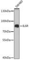 Interleukin 6 Receptor antibody, GTX54364, GeneTex, Western Blot image 