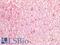 Elastase, Neutrophil Expressed antibody, LS-B4244, Lifespan Biosciences, Immunohistochemistry paraffin image 