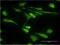 Stress Induced Phosphoprotein 1 antibody, H00010963-M35, Novus Biologicals, Immunofluorescence image 