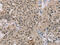 Actinin Alpha 2 antibody, CSB-PA828857, Cusabio, Immunohistochemistry paraffin image 