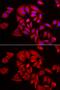 Tousled Like Kinase 2 antibody, GTX32923, GeneTex, Immunocytochemistry image 