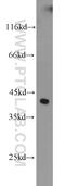 Forkhead Box Q1 antibody, 23718-1-AP, Proteintech Group, Western Blot image 