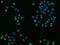Triggering receptor expressed on myeloid cells 2 antibody, 50149-R014, Sino Biological, Immunohistochemistry frozen image 